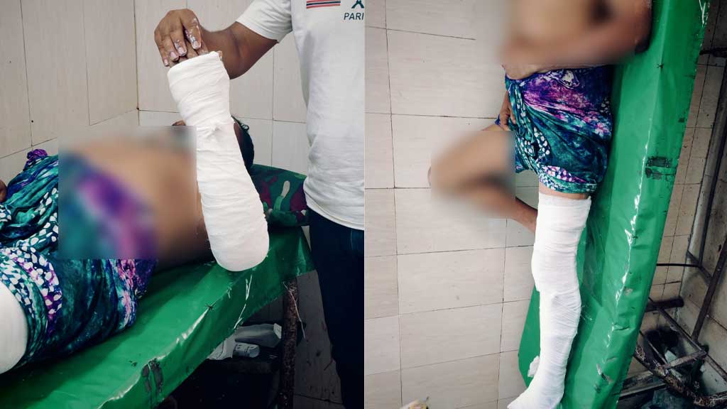 চাঁদা না পেয়ে ব্যবসায়ীকে তুলে নিয়ে হাত-পা ভেঙে দিলেন শ্রমিক দল নেতা