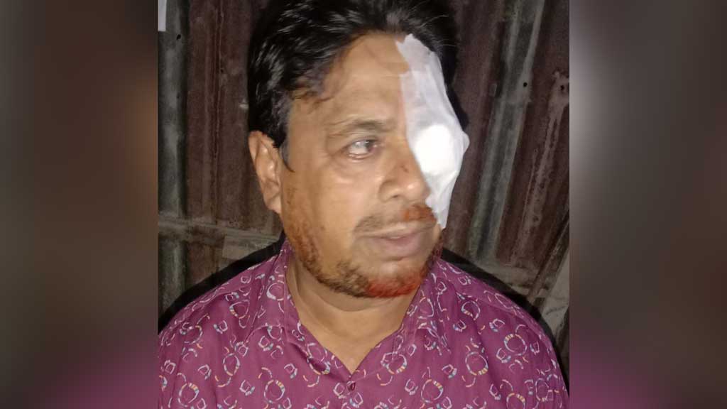 সাঁথিয়ায় জামায়াত নেতাকে মারধরের অভিযোগ, থানায় লিখিত অভিযোগ