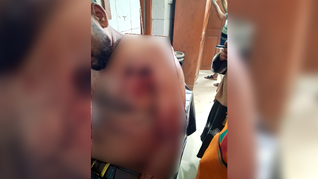 গভীর রাতে পদ্মায় স্পিডবোট ট্রায়াল, গুলিবিদ্ধ যুবক