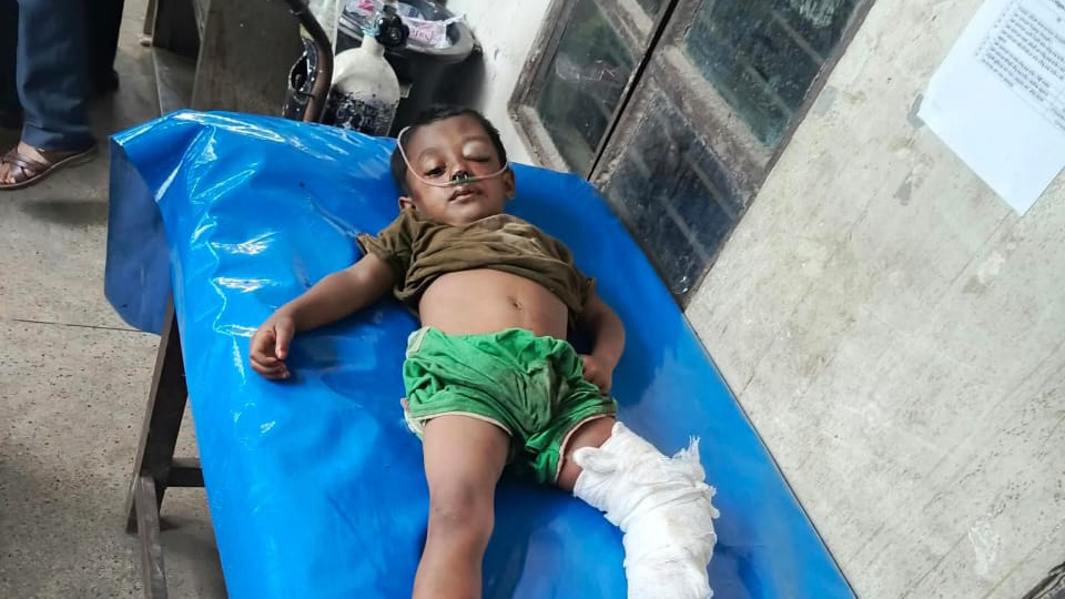 মা ছেড়ে গেছেন, দুর্ঘটনায় বাবা নিহত, হাসপাতালে কাতরাচ্ছে ছোট্ট নাঈম