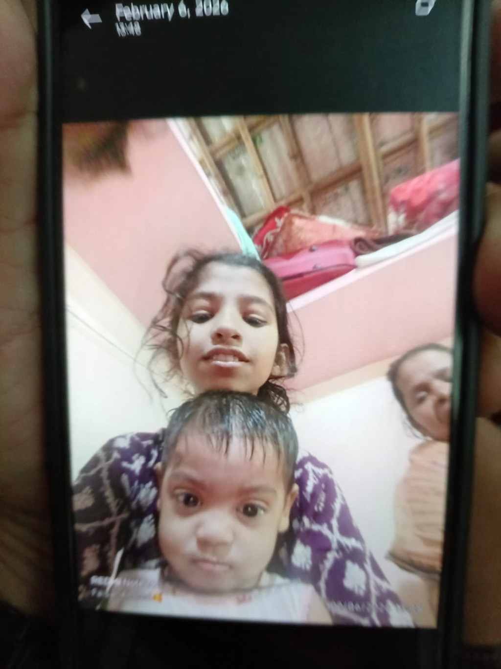 শিশু রেশমির চোখ থেকে গুলি বের করা যায়নি, অবস্থা সংকটাপন্ন