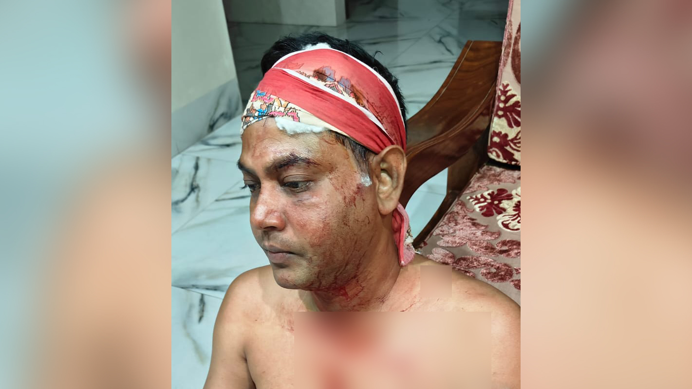 স্বেচ্ছাসেবক দলের দুই নেতার বিরুদ্ধে ‘ভাড়ায়’ ব্যাংক কর্মকর্তাকে পেটানোর অভিযোগ