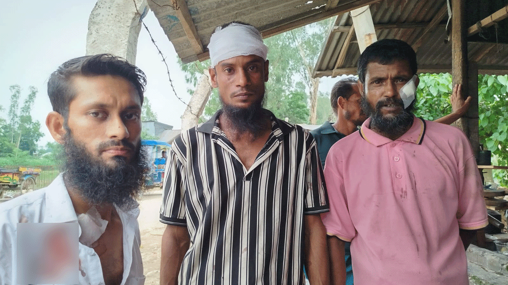 ছাত্রদল-স্বেচ্ছাসেবক দলের দুপক্ষের সংঘর্ষে ১০ জন আহত