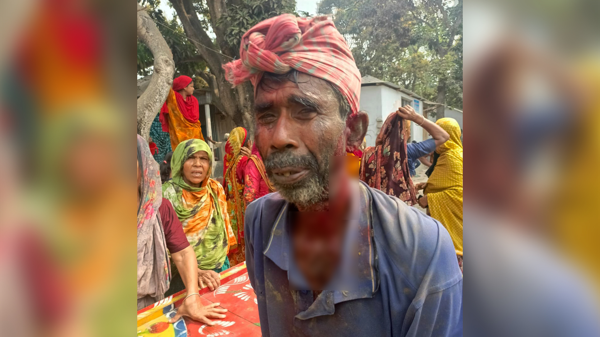 শাহজাদপুরে জমিতে সেচ দেওয়া নিয়ে সংঘর্ষে আহত ১৫