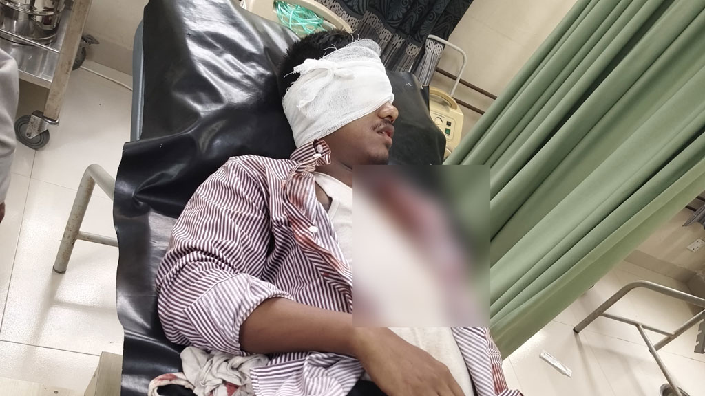 চলন্ত ট্রেনে পাথর নিক্ষেপ, চোখে গুরুতর আঘাত পেলেন যাত্রী