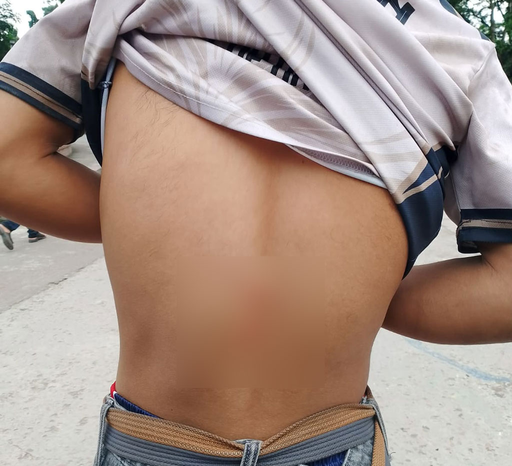 রাবি শিক্ষার্থীকে ছাত্রাবাসে মারধর ও হত্যাচেষ্টার অভিযোগে একজন গ্রেপ্তার