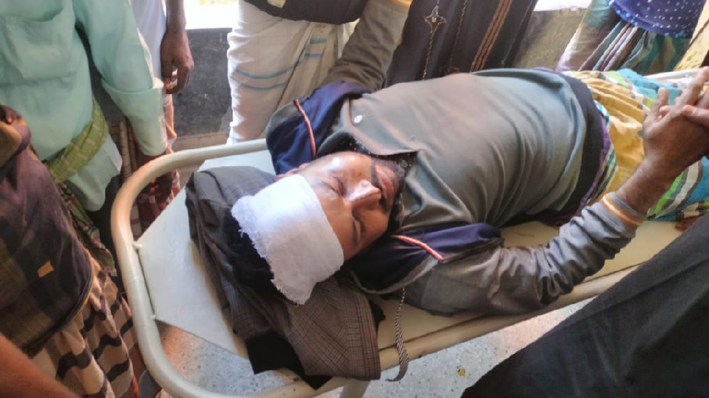 মাছ ধরাকে কেন্দ্র করে সংঘর্ষ, নারী-শিশুসহ আহত ৩০