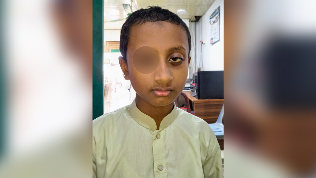 শ্রীপুরে শিক্ষকের বেত্রাঘাতে ক্ষতিগ্রস্ত শিশুর চোখ