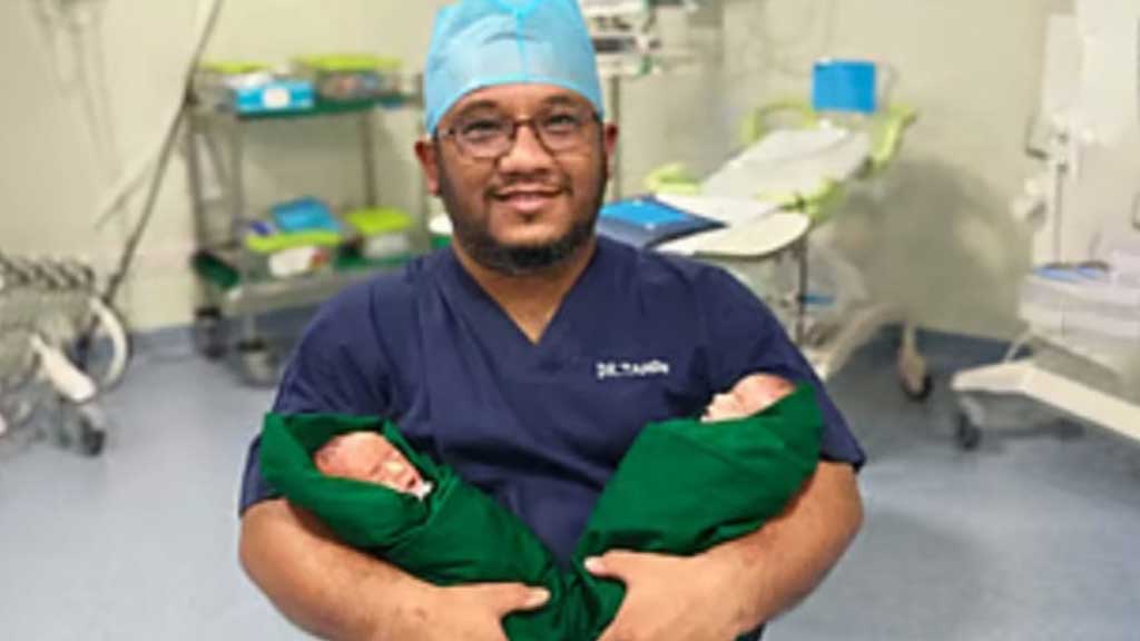 অপারেশনে আলাদা হলো জোড়া লাগানো যমজ শিশু