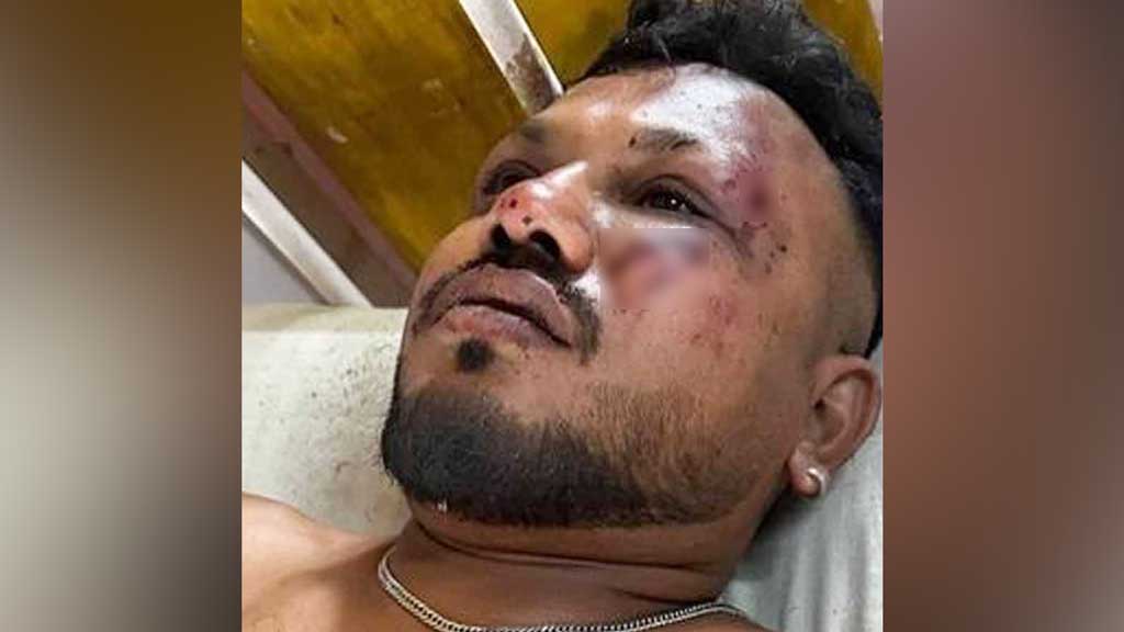 উড়োজাহাজ দুর্ঘটনায় সবাই মরেনি, একমাত্র জীবিত ১১ নম্বর সিটের যাত্রী