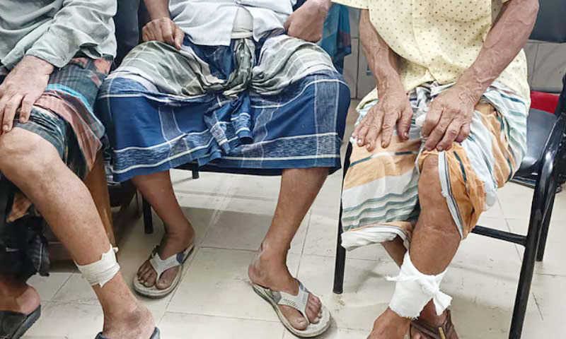 পানবরজে শিয়ালের কামড়ে নারীসহ আহত ১২
