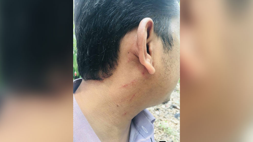 থানার ভেতরে সাংবাদিকদের কিল-ঘুষি মারলেন উপকমিশনার
