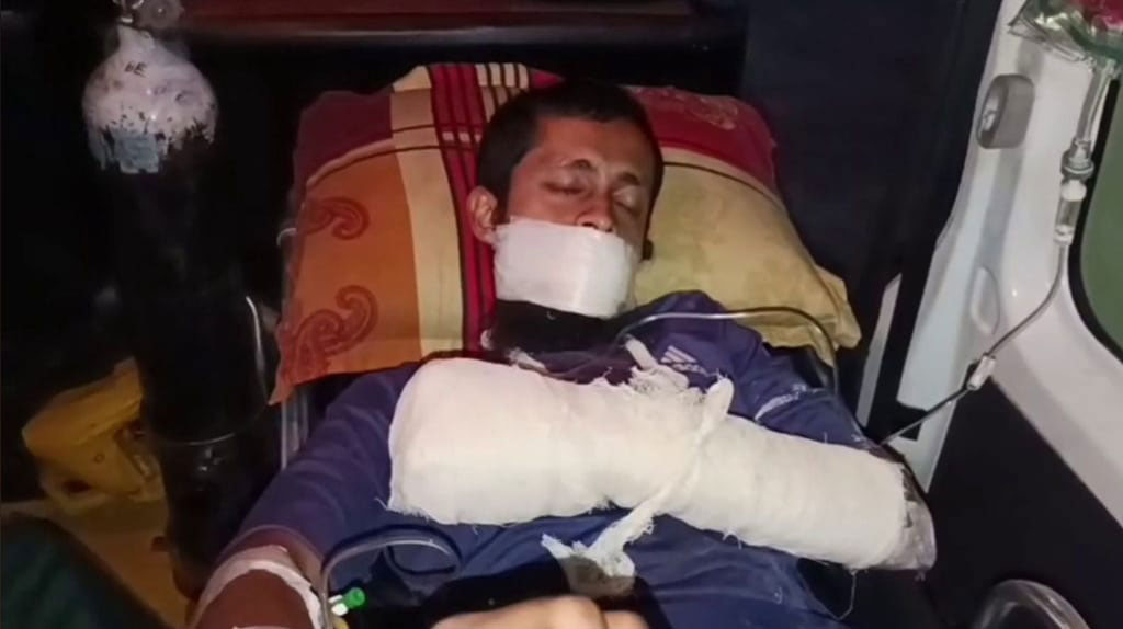 টুঙ্গিপাড়ায় নিজ বাড়িতে বিস্ফোরণে যুবক আহত