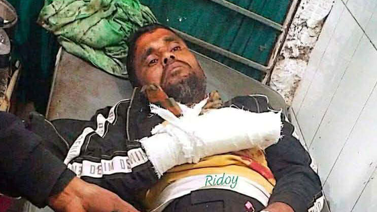 গাইবান্ধায় যুবদল কর্মীকে কুপিয়ে জখম