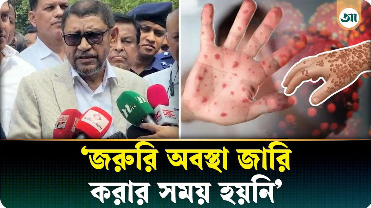 অতীত সরকারের ব্যর্থতায় সারা দেশে হামের ভীতিকর পরিস্থিতি: স্বাস্থ্যমন্ত্রী